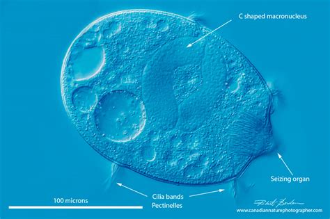 Didinium: This Voracious Predator With Cilia Makes Meals Disappear!