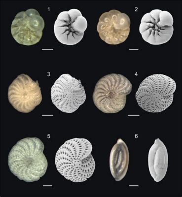  Foraminifera: Een Microscopisch Wonder dat de Oceanen Behuist met Een Schitterend Calcaritisch Skelet!